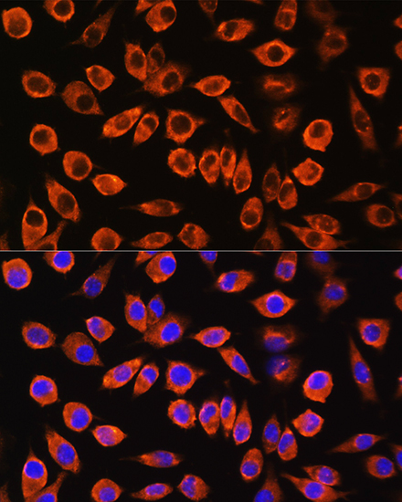 Anti-LAMP2 Antibody (CAB14017)