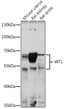 Anti-WT1 Antibody (CAB16298)