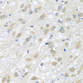 Anti-HARS2 Antibody (CAB7785)