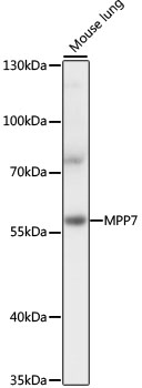 Anti-MPP7 Antibody (CAB16598)