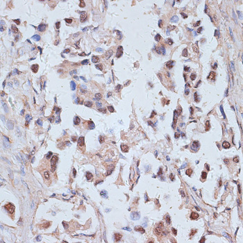 Anti-TAX1BP1 Antibody (CAB17039)