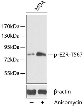 Anti-Phospho-Ezrin-T567 Antibody (CABP0207)