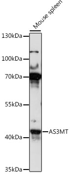 Anti-AS3MT Antibody (CAB16138)