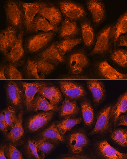 Anti-ACAP2 Antibody (CAB12127)