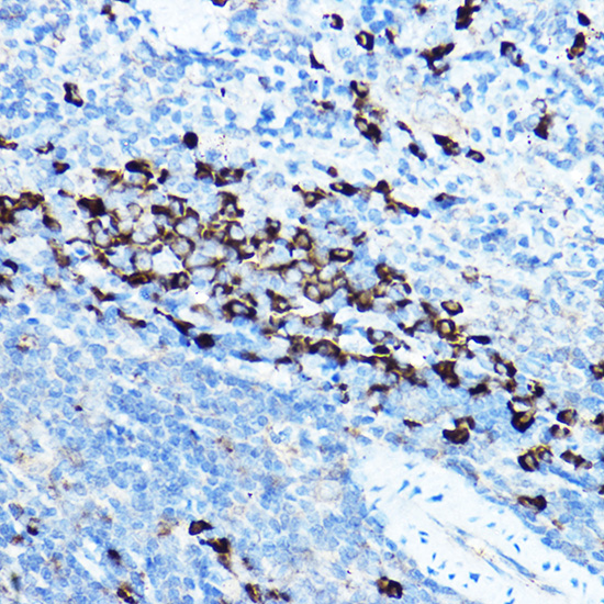 Anti-HSP90B1 Antibody (CAB6272)