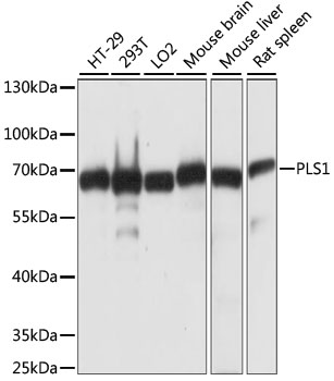 Anti-PLS1 Antibody (CAB15303)