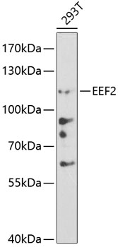 Anti-EEF2 Antibody (CAB0099)