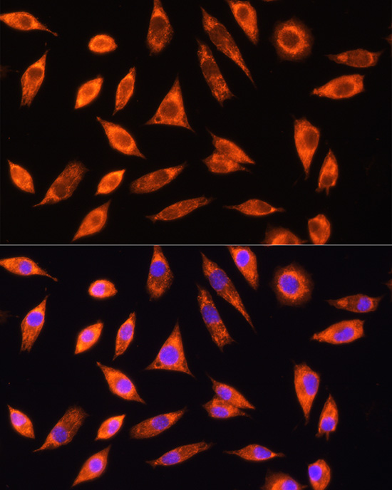 Anti-GALNS Antibody (CAB5461)