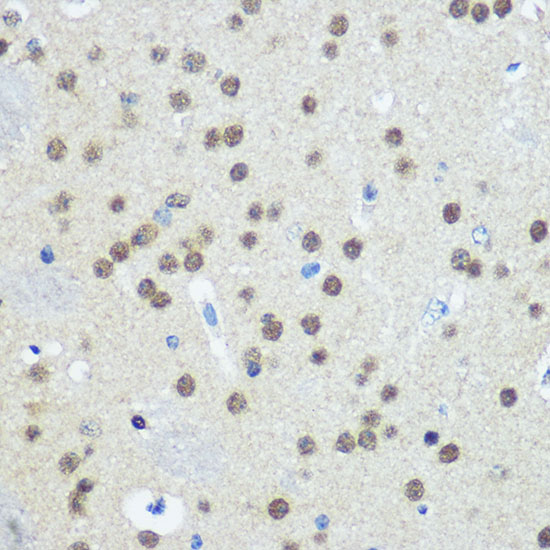 Anti-UBA1 Antibody (CAB12359)