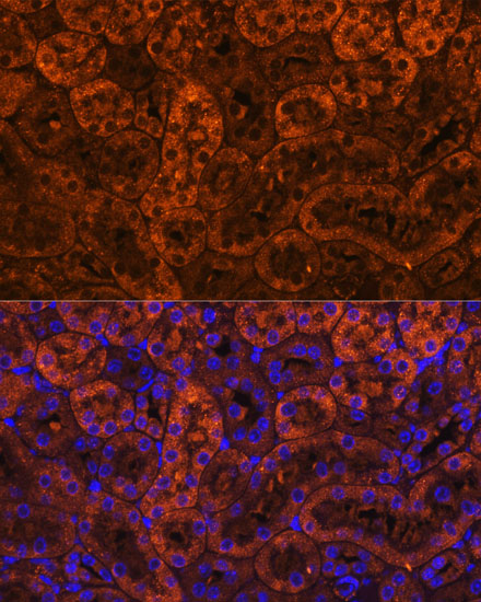 Anti-LAMC2 Antibody (CAB1869)