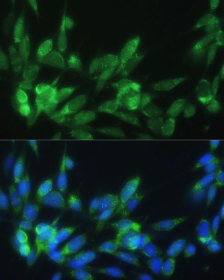 Anti-LRPAP1 Antibody (CAB3004)