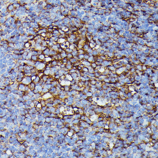 Anti-HLA-B Antibody (CAB1285)