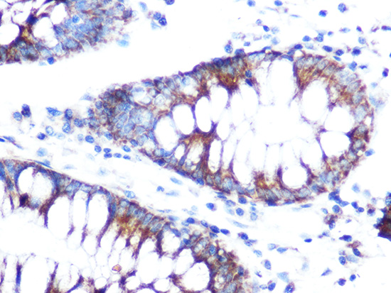 Anti-FOLR1 Antibody (CAB15672)