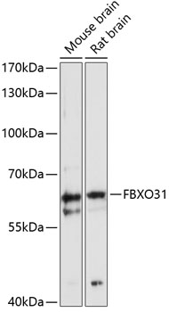 Anti-FBXO31 Antibody (CAB12888)
