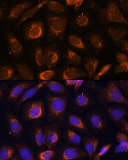 Anti-SHMT1 Antibody (CAB16974)