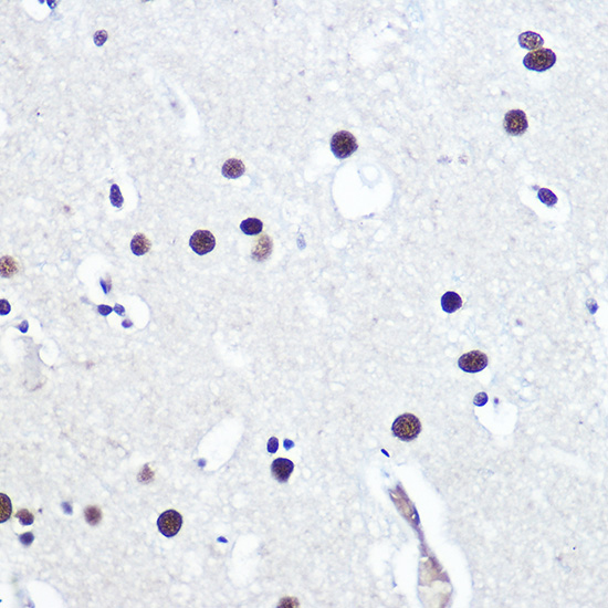 Anti-53BP1 Antibody (CAB5757)