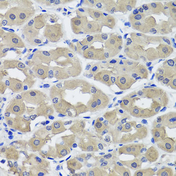 Anti-HSD11B2 Polyclonal Antibody (CAB8077)