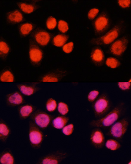 Anti-CHAMP1 Antibody (CAB11690)