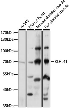 Anti-KLHL41 Antibody (CAB15383)