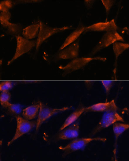 Anti-FGG Antibody (CAB5642)