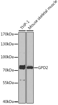 Anti-GPD2 Antibody (CAB16378)