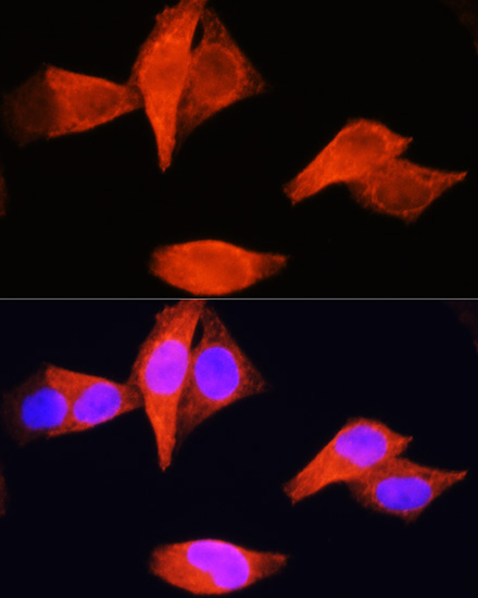 Anti-PSAT1 Antibody (CAB6707)