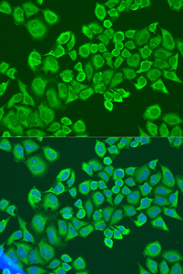 Anti-IGF2BP2 Antibody (CAB2749)