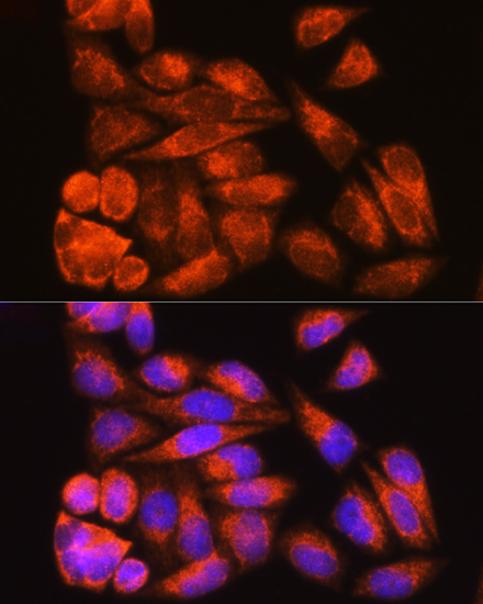 Anti-ODF2 Antibody (CAB15630)