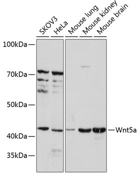 Anti-Wnt5a Antibody (CAB2133)