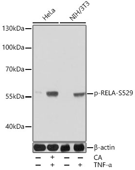 Anti-Phospho-RELA-S529 Antibody (CABP0944)