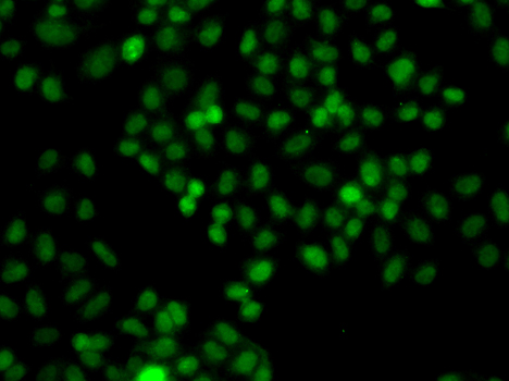 Anti-PIP5K1A Antibody (CAB7941)