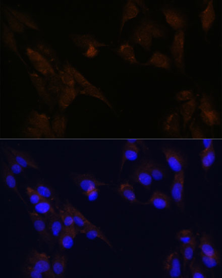 Anti-CD133 Antibody (CAB0219)