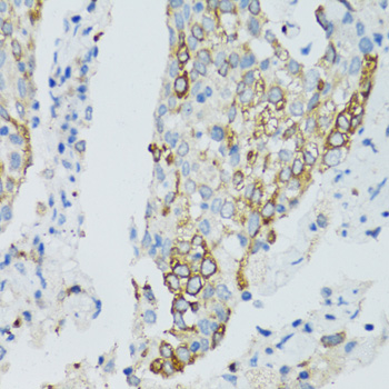 Anti-SIRT2 Antibody (CAB0273)