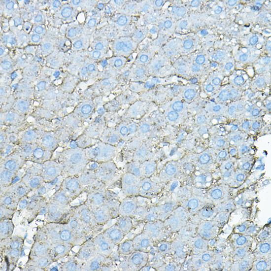 Anti-ASGR1 Antibody (CAB13279)