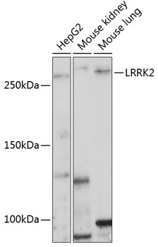 Anti-LRRK2 Antibody (CAB17253)