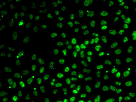 Anti-PPP1R8 Antibody (CAB6701)