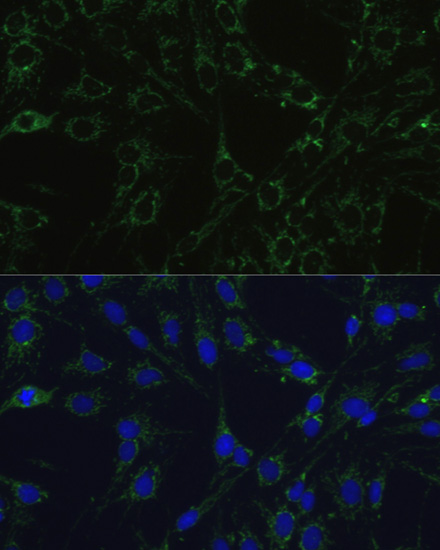 Anti-COX5B Antibody (CAB2640)