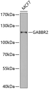 Anti-GABBR2 Antibody (CAB6594)