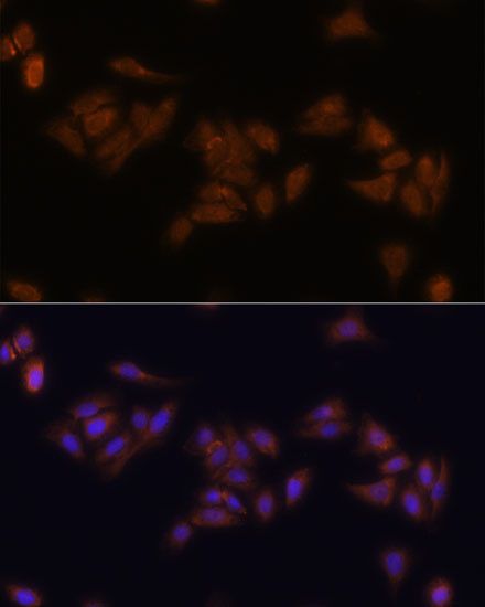 Anti-RPS17 Antibody (CAB16426)