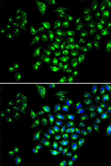 Anti-RUNX1 Antibody (CAB2055)