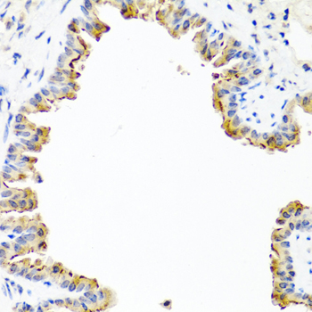 Anti-COL10A1 Antibody (CAB6889)