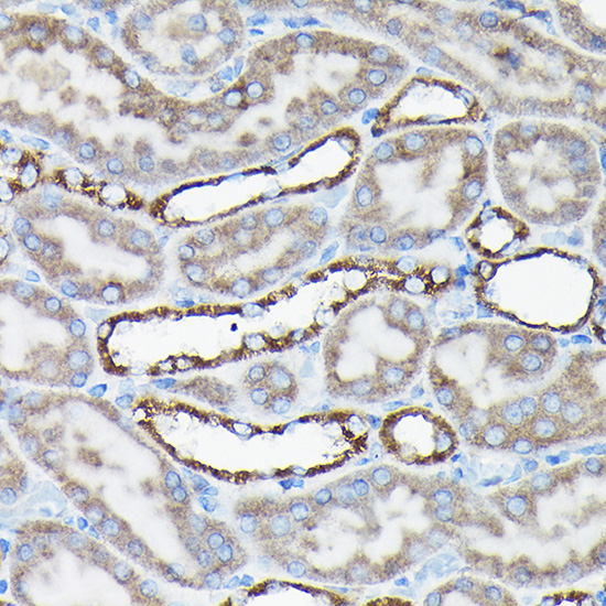 Anti-AIF Antibody [KO Validated] (CAB2568)