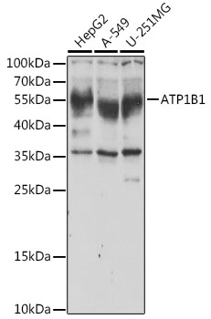 Anti-ATP1B1 Antibody (CAB5793)