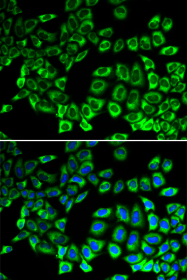 Anti-AIMP1 Antibody (CAB5301)