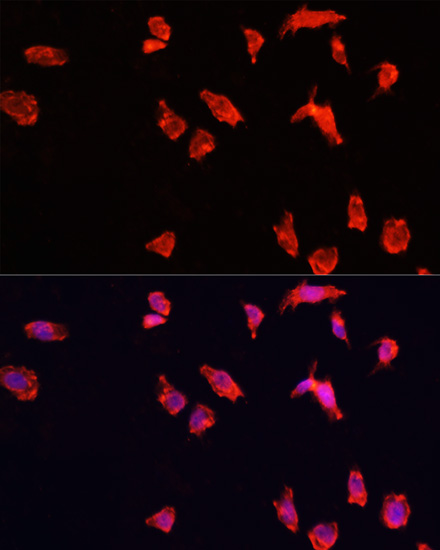 Anti-ATP6V1B2 Antibody (CAB3754)