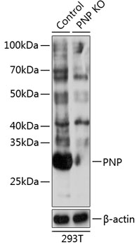 Anti-PNP Antibody [KO Validated] (CAB19886)