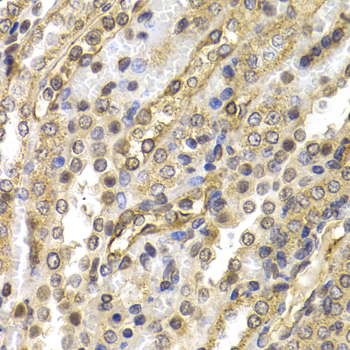 Anti-NEDD9 Antibody (CAB2521)