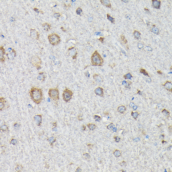 Anti-MTHFD1L Polyclonal Antibody (CAB7969)