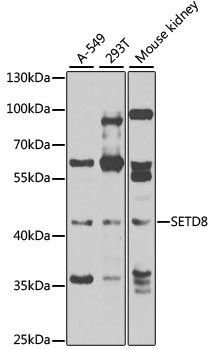 Anti-SETD8 Antibody (CAB7305)