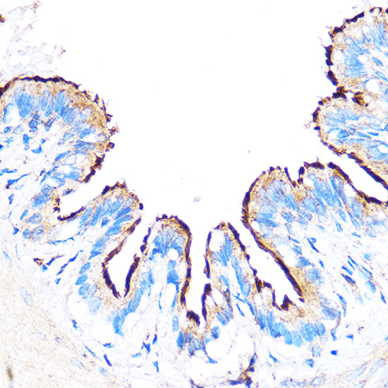 Anti-PDXP Antibody (CAB17455)